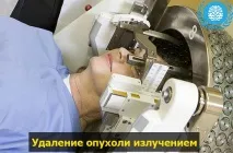 Видалення пухлини головного мозку головного