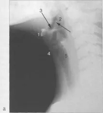 luchevaya_anatomiya_gortani