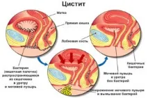Брусниця при циститі як приймати листя брусниці листя