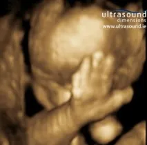Думаєте, ультразвук безпечний для дітей дітей