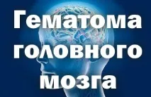 мозку