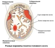 мозку