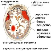 допомога