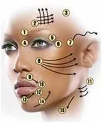 Juvederm Ultra 3 (Ювідерм ультра 3) - що це таке, ціни, відгуки, фото ультра