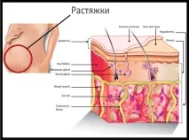 папата