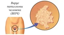 шийки