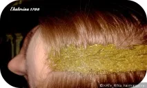 Я беру участь у марафоні» участь