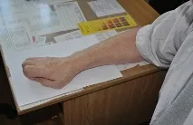М’язова спастика лікування у санаторно-курортних умовах лікування