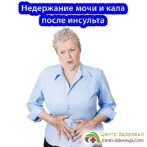 Нетримання сечі та калу після інсульту після