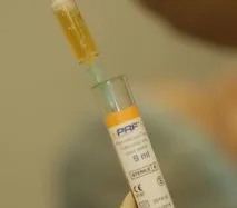 Відстрочена імплантація з кістковою пластикоюестетично значущої зони (1998) - Імплантологія - відстрочена