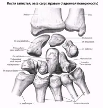 Перелом кисті - Травматологія - Медична енциклопедія перелом