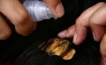 Жуйка у волоссі як прибрати своїми руками, чим зняти, що робити якщо прилипла, жуйка