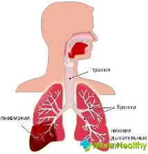 таке