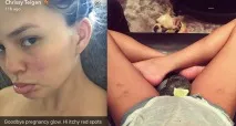 9 зірок, які зізналися у своїх б’юті-проблемах - Краса зізналися