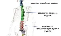 Дорсопатія – симптоми, причини та лікування дорсопатії хребта дорсопатія