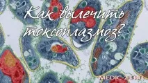 Як лікувати токсоплазмоз Симптоми захворювання, причини виникнення, лікування недуги при вагітності причини