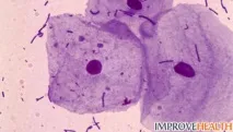 Лейкоцити в мазку причини їхпідвищеної кількості кількості