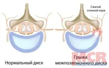 лечение