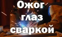 Опік ока зварюванням що робити, лікування в домашніх умовах домашніх