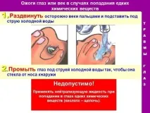 Опік ока зварюванням що робити, лікування в домашніх умовах лікування