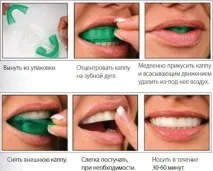 Відбілювання зубів у Мінську - вартість вартість
