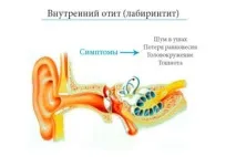 чому