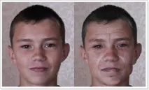 алкоголізму