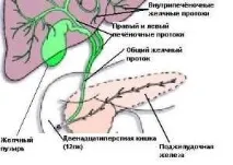 Холецистит, Медичний центр Імунітет та здоров’я - Здоров’я Інфо холецистит