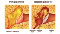 антибиотици