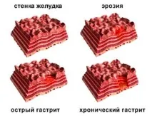 Артишок – корисні та шкідливі властивості, способи застосування властивості