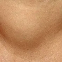 залози