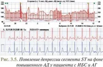 рівня
