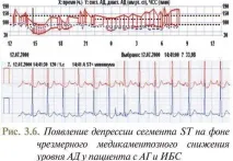 моніторування