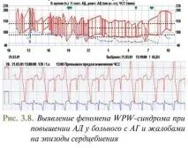 моніторування