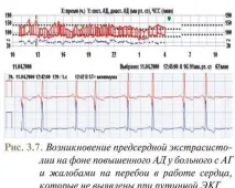 моніторування