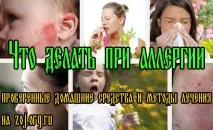 Очі, Здоров’я - блог Захара Журавльова - Part 2 захара