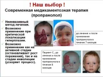 Гемангіома у дітей до року - причини появи на обличчі та нозі, лікування (видалення лазером) дітей