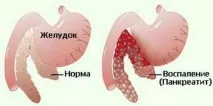 симптоми