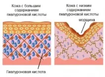 Контурна пластика обличчя - ціна обличчя