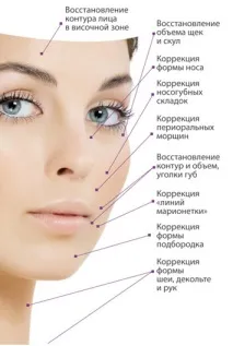 Контурна пластика обличчя - ціна контурна