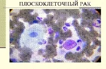 являється