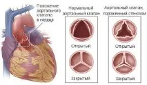 заболяване