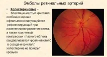 Алгоритм виконання підшкірної ін’єкції виконання