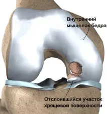 кеніга