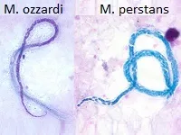 Філярії – життєвий цикл, класифікація, види, морфологія, фото цикл