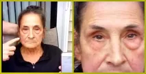 Крем Instantly Ageless склад, властивості, як наносити на шкіру ageless