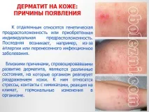 Шкірний дерматит - фото, лікування, важливе про захворювання лікування
