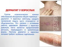 Шкірний дерматит - фото, лікування, важливе про захворювання лікування