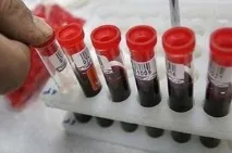Менінгіт - причини, симптоми, діагностика, лікування, ускладнення менінгіт