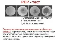 Висівкоподібний лишай (різнокольоровий, кольоровий) лікування та причини появи лікування
